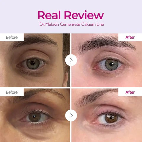 Dr.Melaxin Calcium Intense Firming Cream with Collagen & Elastin, Lifting & Volumizing Face Cream for Sagging Skin, Niacinamide for Plumping Care