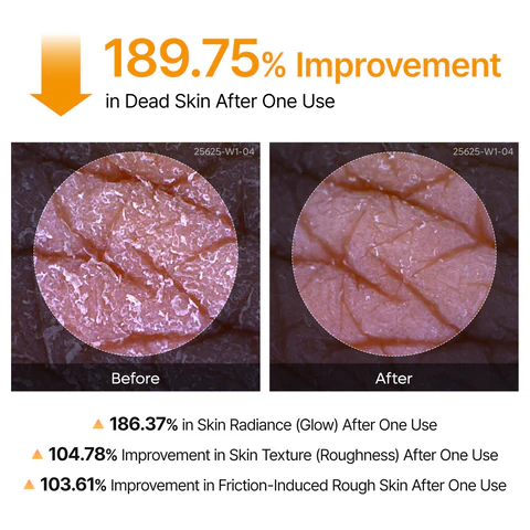 Dr.Melaxin Body Keratin Care Kojic Acid Turmeric Spray with AHA & PHA, Gentle Body Brightening & Exfoliating Peeling Solution for Dead Skin Cells & Texture, Korean Skincare, 6.76 fl.o