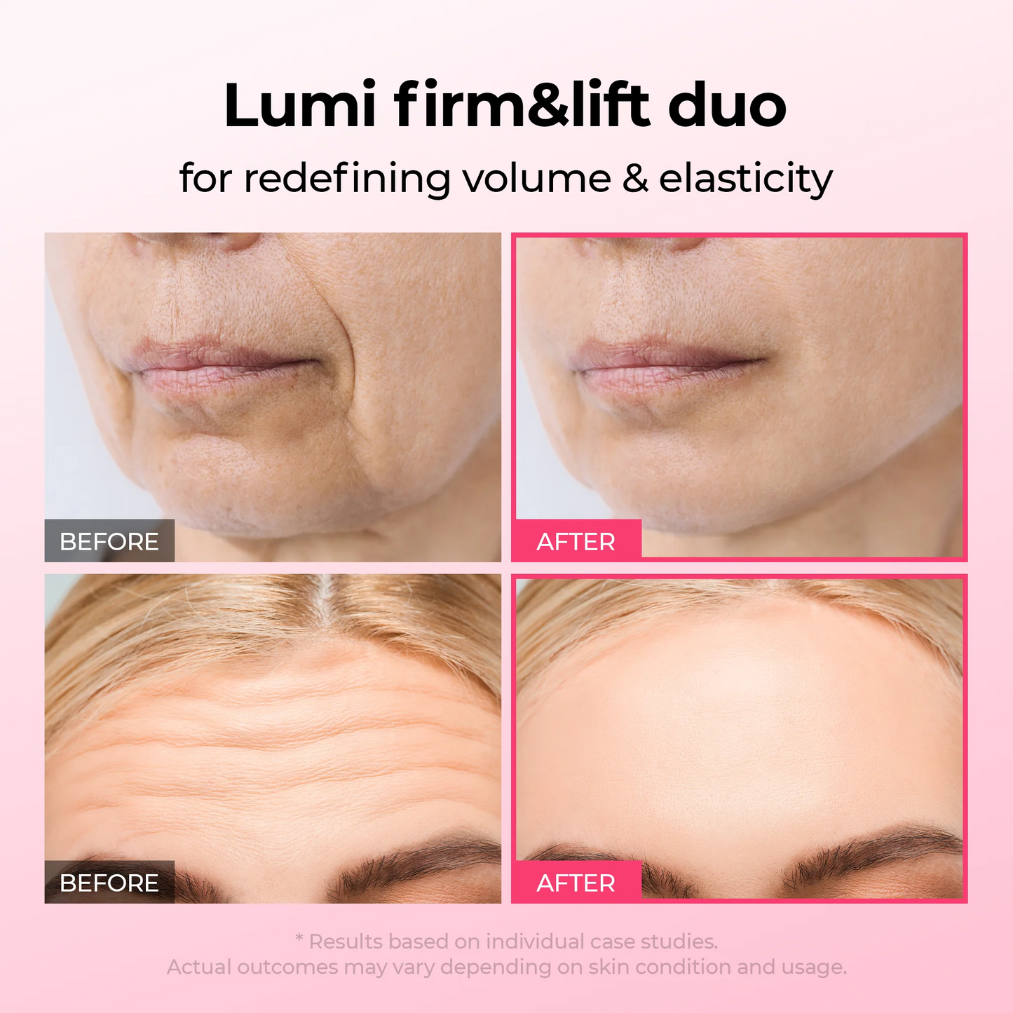 Dr.Melaxin Lumi firm & lift Duo | Korean facial Collagen Firming serum plumping skin & tightening refines skin repair density | Cyano Pink Spicule Serum + Picotonic Shot Ampoule